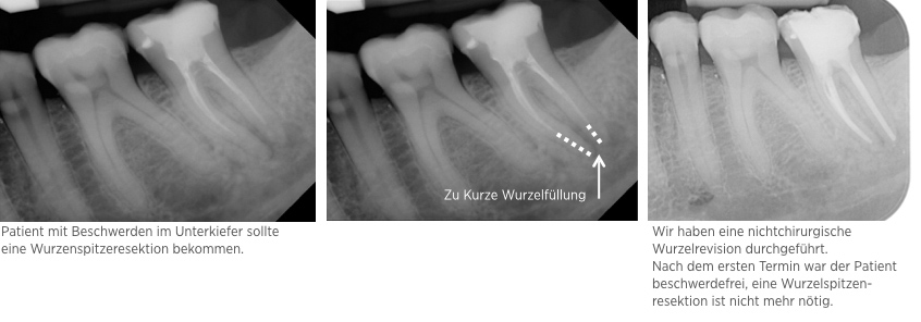 endodontie 3